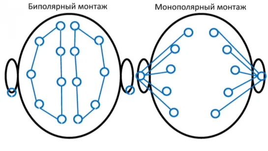 2. Электроэнцефалография. Технические основы