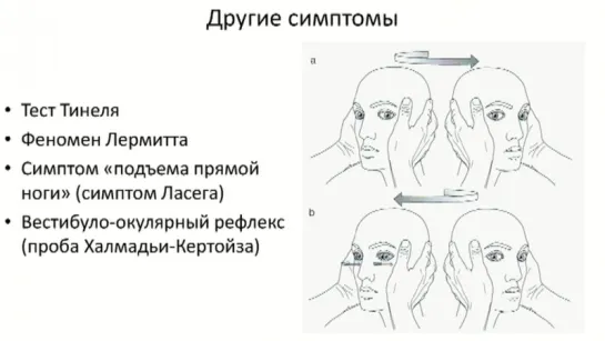 Методика неврологического осмотра. Часть 23