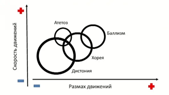 Методика неврологического осмотра. Часть 22