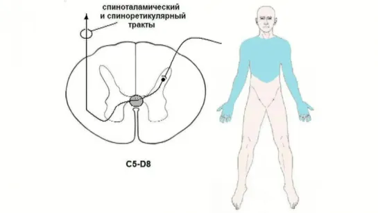 Методика неврологического осмотра. Часть 20