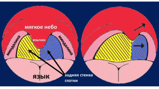 Методика неврологического осмотра. Часть 12