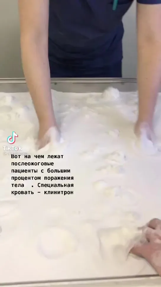 Кровать для ожоговых больных