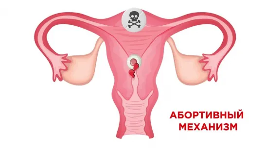 Абортивные механизмы гормональной контрацепции