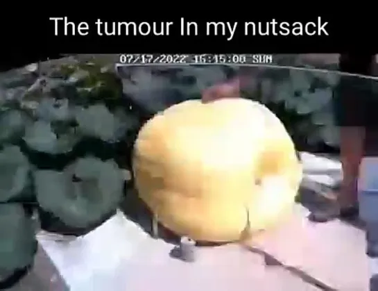 the_tumor_in_my_nutsack