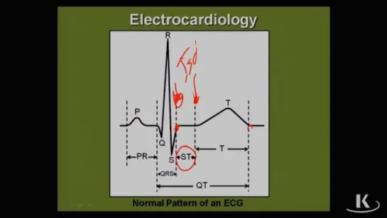 Physio_Fischer_Sec02_Ch03e_Electrocardiology