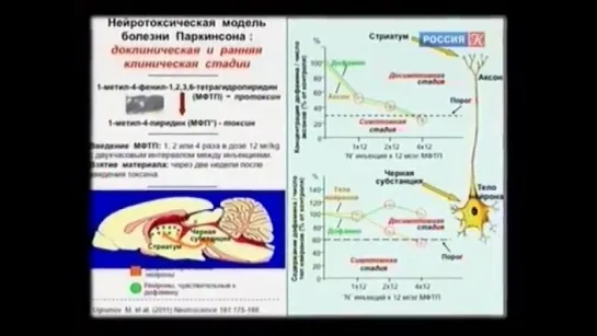 Михаил Угрюмов -  Болезни мозга часть 2