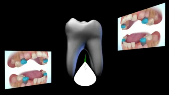 Регенерация зубов _ Tooth Regeneration