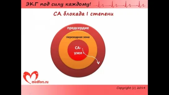 [6. ЭКГ под силу каждому] — Блокады, часть 1: СА-, АВ-, внутрипредсердные блокады