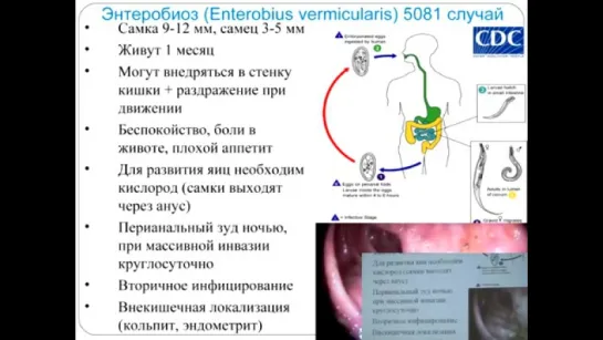 Гельминтозы. Часть 3. Поражения кишечника