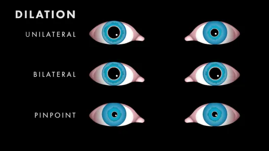 17 Control of the Pupil Neuroanatomy Video Lab - Brai