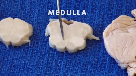 14 Sensation from the Body Neuroanatomy Video Lab - B