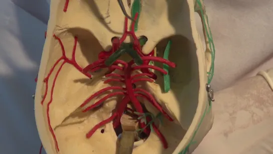 10 Cerebral Circulation Neuroanatomy Video Lab - Brai