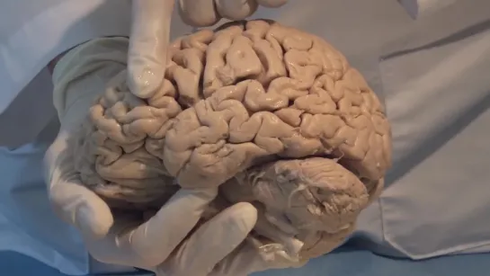 1 Introduction Neuroanatomy Video Lab - Brain Dissec