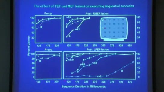 11. The neural control of visually guided eye movements 2