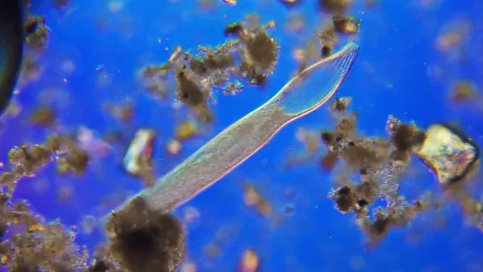 Spirostomum.