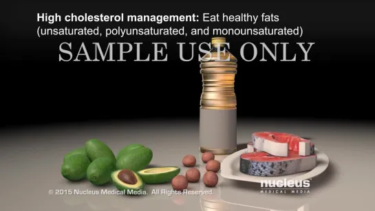 4. Managing High Cholesterol _ Nucleus Health