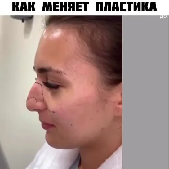 Как меняет пластика