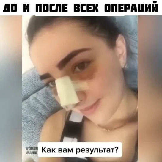 До и после всех операций