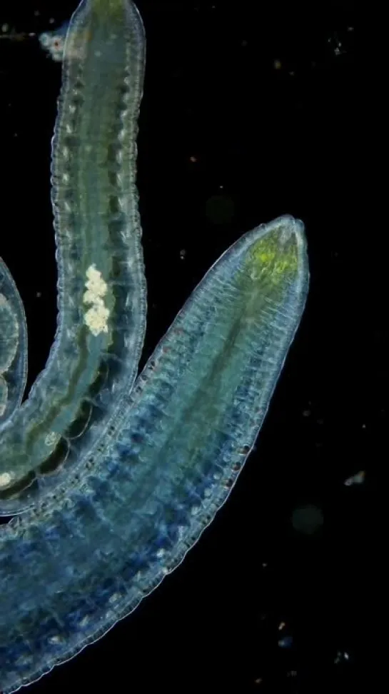 Freshwater Annelids от  science_intoimages