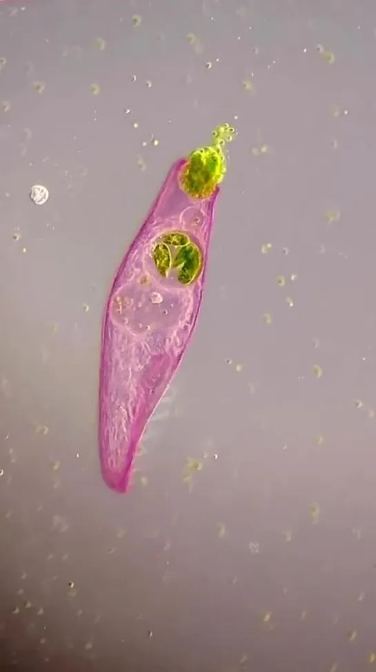 Ciliates like Paramecium and Blepharisma от Chloé Savard