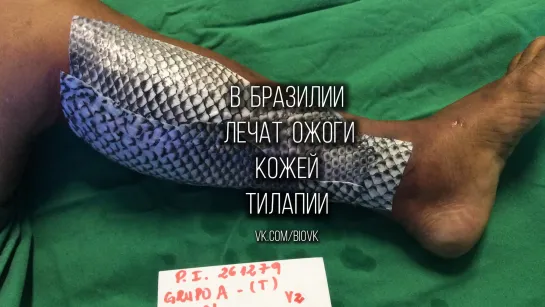 Tilapia_skin