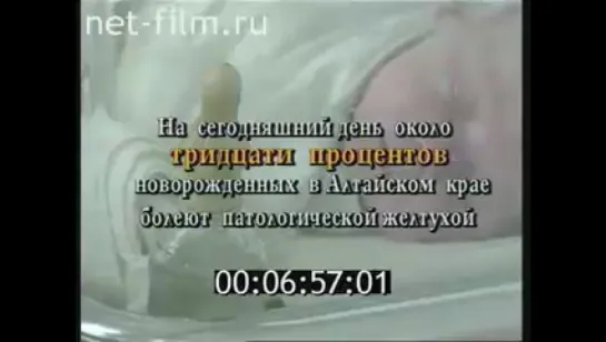 Эпидемия патологической желтухи на Алтае (1994)