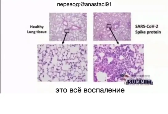 Видео от Независимая Ассоциация врачей