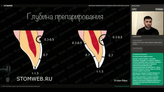 Адгезивные керамические реставрации, разбор клинических случаев