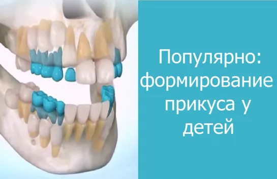 Популярно: формирование прикуса у детей. Ортодонтия. Стоматология.