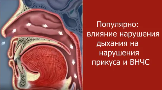 Популярно: влияние нарушения дыхания на нарушения прикуса и ВНЧС. Ортодонтия. Стоматология