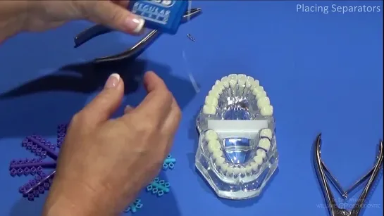 Straight Wire Orthodontics Spacers Demo