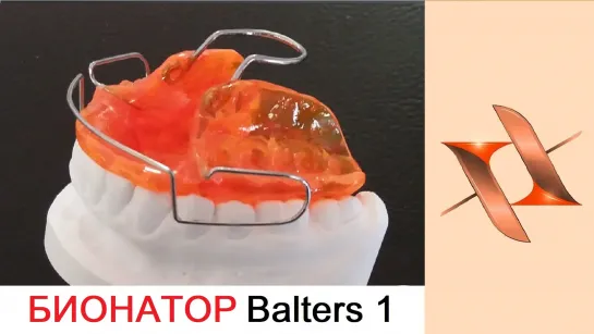 Бионатор Балтерс 1 (Balters). Ортодонтический аппарат.