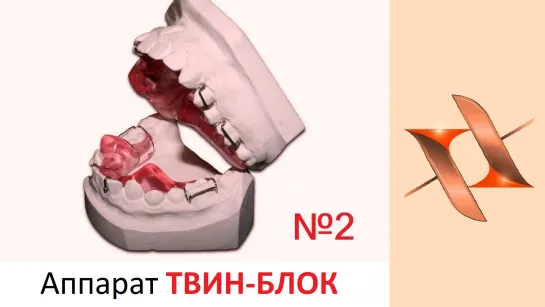 Функциональный аппарат Твин Блок - Twin Block. Часть 2. Ортодонтия.