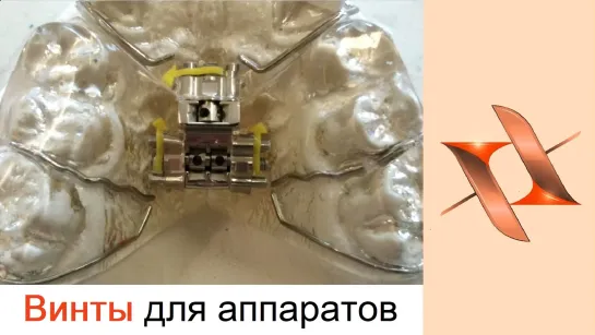 Винты для ортодонтических аппаратов.