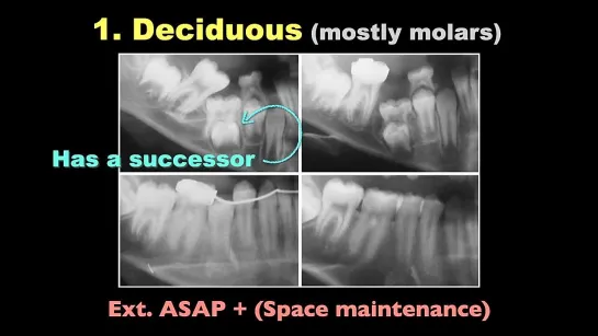 Chris Chang Ortho.  Case Analysis：Ankylosis