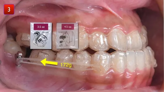 Chris Chang Ortho.  Elastics Research