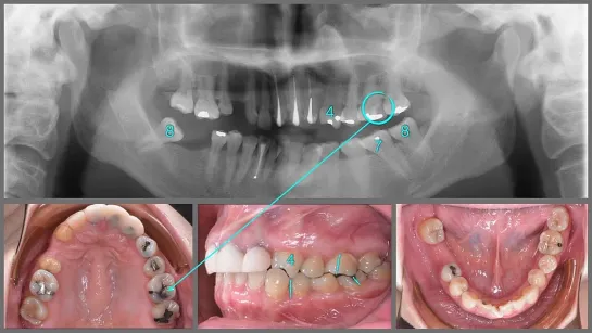 Chris Chang Ortho  ABO Case Report. Ортодонтия.