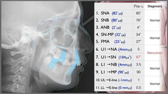 Chris Chang Ortho. ABO Case Report