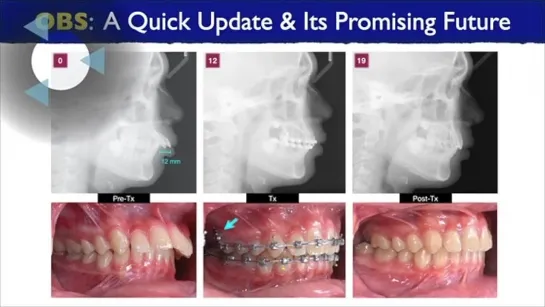 Chris Chang Ortho. Article Preview