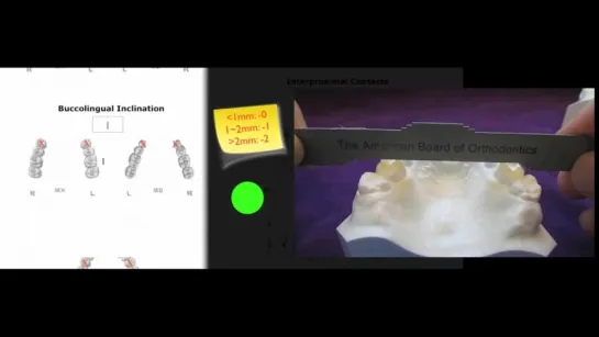 Asymmetrical Extraction. Ортодонтия