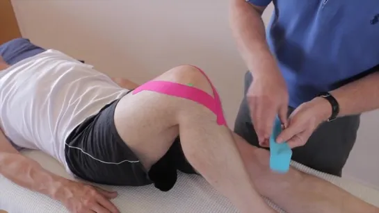 How to treat Knee Pain (Patellofemoral Pain syndrome) using Kinesiology tape