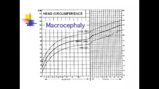 04 - Head Circumference