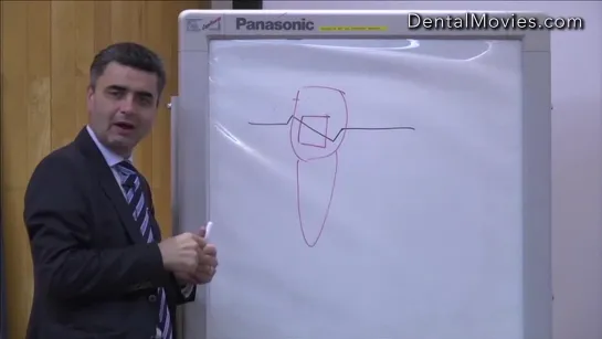 Practical wire bending tips in contemporary orthodontics for ideal case finishin