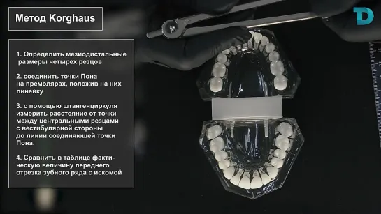 Диагностика в ортодонтии. Метод Korghaus - Хади Наталья Аднановна