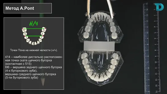 Диагностика в ортодонтии . Урок 2 . Метод A.Pont (Пона) - Хади Наталья Аднановна