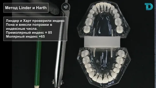 Диагностика в ортодонтии  Метод Linder и Harth   - Хади Наталья Аднановна