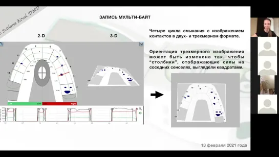 Свойства датчика Т скан. Как работает анализ окклюзии Т-скан