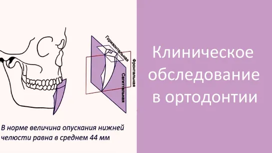 Клиническое обследование пациента. Пропедевтика ортодонтии. МГМСУ. Стоматология