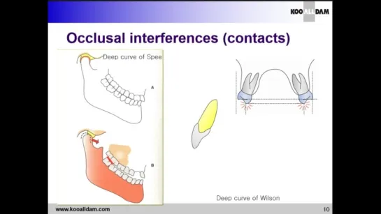 Denture pattern analysis. Корейский ролик Ортодонтия.