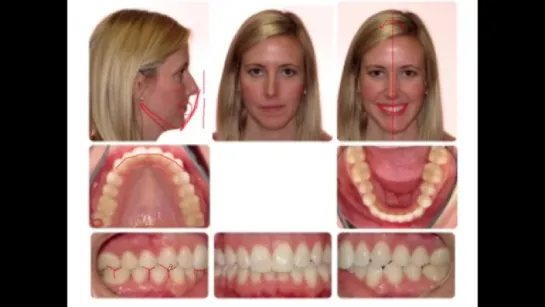 Orthodontics- Diagnosis and Treatment Planning. Ортодонтия